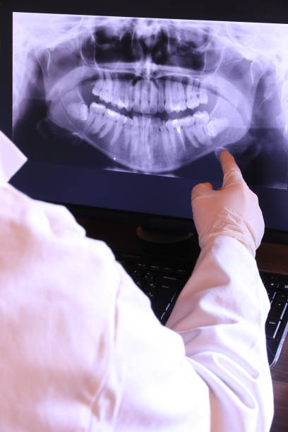 Best Emergency Tooth Extraction in Austintown, OH